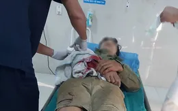 Thêm ca cấp cứu bị máy cưa gỗ cắt vào tay, bác sĩ cảnh báo cẩn trọng với tai nạn lao động