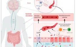Vi khuẩn đường ruột có liên quan đến bệnh tự kỷ