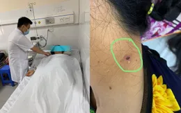 Nhiễm trùng, suy chức năng gan do bị sốt mò