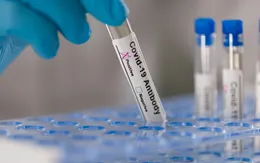 Mỹ cấp phép sử dụng khẩn cấp kháng thể Regeneron để điều trị bệnh nhân COVID-19