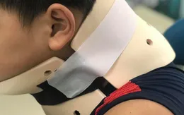 Bắt chước video trên mạng, bé trai chấn thương cột sống cổ