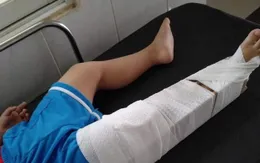 Tạm đình chỉ cô giáo làm bé 3 tuổi gãy xương đùi trong lớp