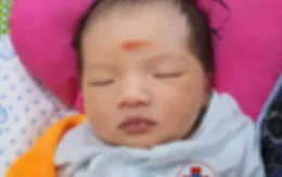 Cấp cứu tối khẩn, cứu thai nhi bị sa dây rau