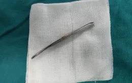 Lấy cây nhíp thép dài 10cm xuyên thủng từ miệng lên sàn mũi bé 1 tuổi