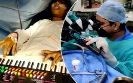 Cô bé Ấn Độ chơi đàn trong khi đang phẫu thuật não