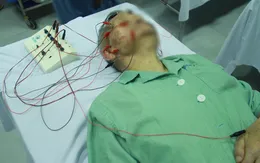 Cảnh báo bệnh liệt mặt, méo miệng khi trời trở lạnh