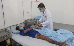 Cấp cứu điều trị bệnh nhân bị bỏng nước sôi 23% diện tích cơ thể