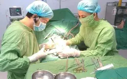 Nối thành công động mạch ngón tay trỏ bị máy cưa cắt đứt