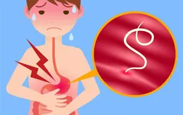 Tẩy giun cho trẻ và những điều cần lưu ý