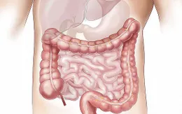 Rối loạn hoóc môn ruột điều hòa chất béo ở những người bị gan nhiễm mỡ