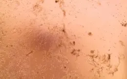 Châu Âu lần đầu nuôi cấy thành công chủng virus corona mới