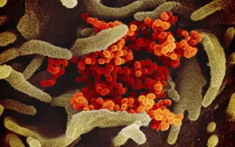 WHO công bố tên của loại virus gây ra dịch bệnh COVID-19 là SARS-COV 2
