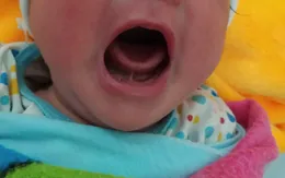 Dùng gai bưởi chữa chậm nói, cháu bé phải nhập viện