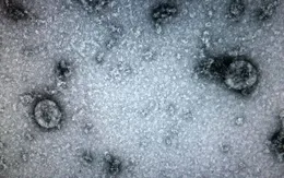 Việt Nam nuôi cấy và phân lập thành công virus corona