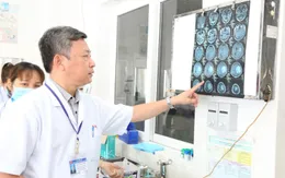 Lấy khối u màng não phức tạp, gây liệt nửa người