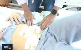 Phẫu thuật thành công ca tắc ruột hiếm gặp