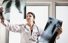 Tỷ lệ sống của bệnh nhân ung thư ở Nhật Bản tăng rõ rệt