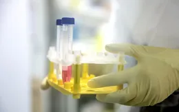 Nhật Bản phát triển vaccine ADN phòng chống virus SARS-CoV-2