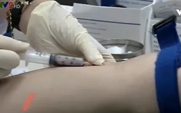 Sàng lọc trước khi sinh bằng các biện pháp thăm dò đặc hiệu