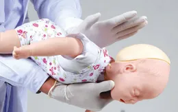 Cứu sống bệnh nhi ngừng tuần hoàn do sặc cháo