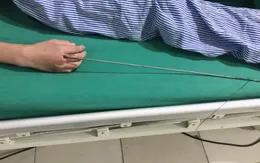 Ra suối bắn cá bằng súng tự chế, bé trai 13 tuổi bị mũi tên kim loại dài 60cm xuyên vào tay