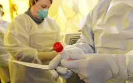 FDA cho phép xét nghiệm nước bọt để chẩn đoán COVID-19