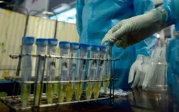 Sức khỏe bệnh nhân COVID-19 thứ 91 có tín hiệu lạc quan