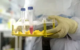Mùa hè 2020, Viện Pasteur (Pháp) sẽ thử nghiệm vaccine phòng COVID-19 ở người