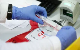Đức xét nghiệm kháng thể SARS-CoV-2 đại trà