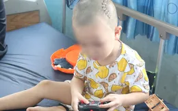 Ngã từ trên gác cao 3m xuống đất, bé trai bị lõm sọ
