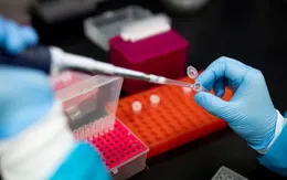 Mỹ cho phép sử dụng xét nghiệm kháng nguyên virus SARS-CoV-2 đầu tiên