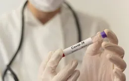 Cả 1 tầng chung cư TP.HCM phải xét nghiệm COVID-19, Bộ Y tế nói gì?
