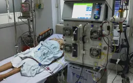 Thay huyết tương cứu sống bệnh nhân hôn mê gan