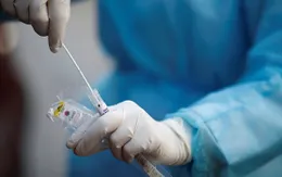 Nhật Bản chấp thuận bộ xét nghiệm nhanh virus SARS-CoV-2