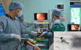 Bé 4 tuổi vào viện cấp cứu vì nuốt phải móc đồ chơi