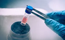 Nhật Bản sử dụng tế bào gốc phôi điều trị bệnh về gan