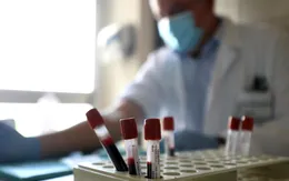Italy thử nghiệm thành công kháng thể chống virus SARS-CoV-2