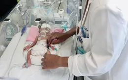 Cứu sống kịp thời bé sơ sinh non tháng bị teo ruột non nhỏ nhất Việt Nam