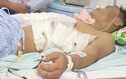 Khẩn nguy cứu người đàn ông bị đâm thấu ngực bụng
