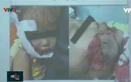 Bảo vệ trẻ em trước rủi ro của vật nuôi