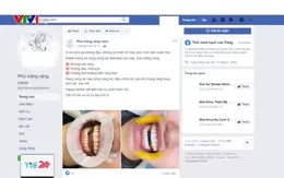 Coi chừng "tiền mất, tật mang" vì lạm dụng bọc răng thẩm mỹ!