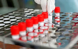 Nhật Bản cho phép xét nghiệm virus SARS-CoV-2 qua nước bọt