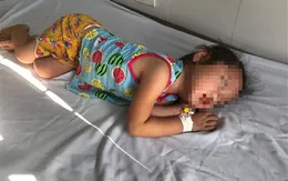Cảnh báo viêm não ở trẻ