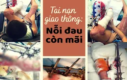 Cẩn trọng: Tai nạn giao thông gây thương tích nặng ở trẻ
