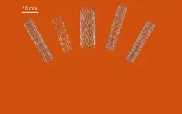 Australia đột phá trong sản xuất stent nhờ công nghệ in 3D