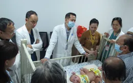 93 nhân viên y tế sẵn sàng cho ca mổ tách dính phức tạp đầu tiên tại Bệnh viện Nhi đồng Thành phố