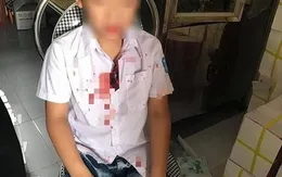 Khởi tố phụ huynh đánh bạn của con trước cổng trường học