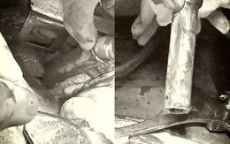 Ngã trên cây cao 4m xuống đất, người đàn ông bị ống nhựa đâm xuyên ngực