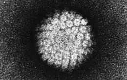 Virus HPV có thể gây ung thư tuyến tiền liệt