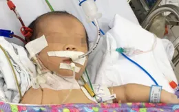 Lọc máu thành công cứu sống trẻ sơ sinh bị bệnh hiếm